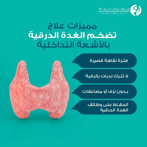 علاج تضخم الغدة الدرقية بدون جراحة مركز الحياة